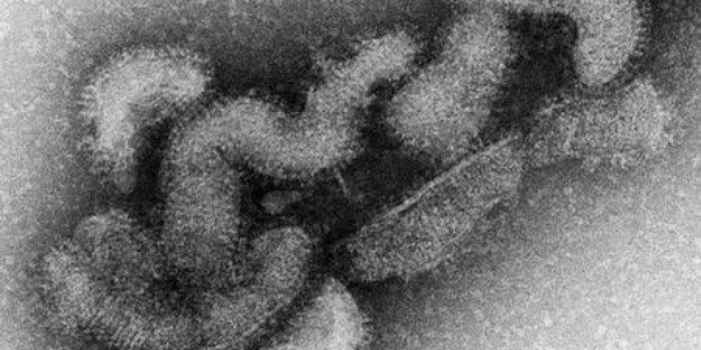 Le Japon enregistre le premier décès au monde dû au virus Oz