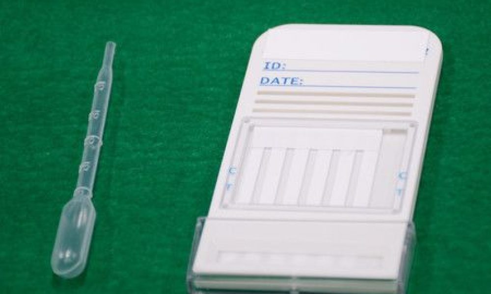 « Drogue du violeur » : un kit de détection hyper-rapide distribué dans les postes de police du Japon