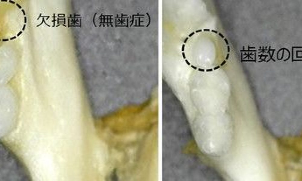 Des chercheurs japonais développent un médicament qui fait pousser les dents